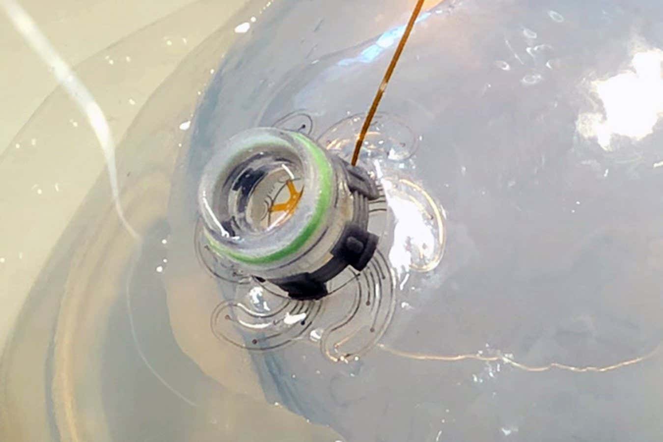 Robot injected into the skull deploys its tentacles to monitor the brain

