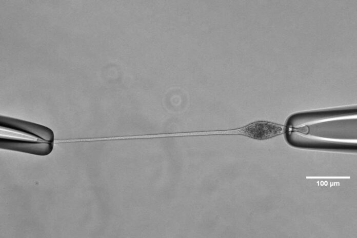 The cell being held via two micropipettes to elongate the neck