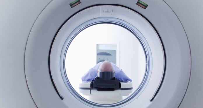 Subtle Medical receives Phase II funding approval to boost imaging technology